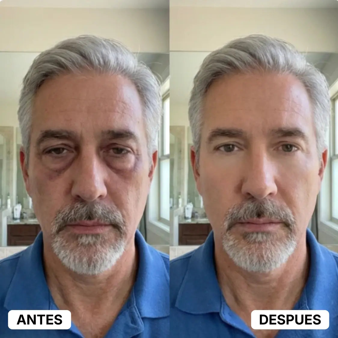 Focus Eye Cream